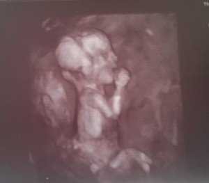 Babuci  első fotója